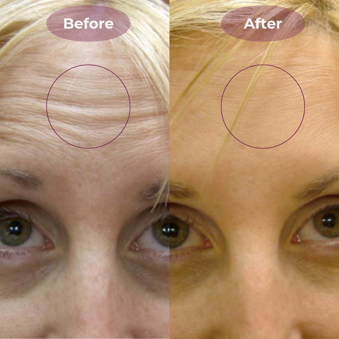 Fade Wrinkles & Fine Lines Naturally