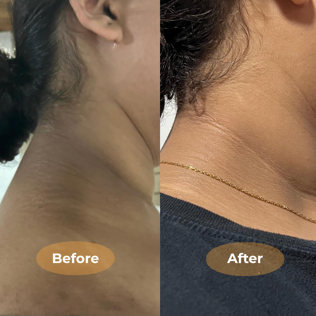 Brighten Stubborn Dark Areas Naturally