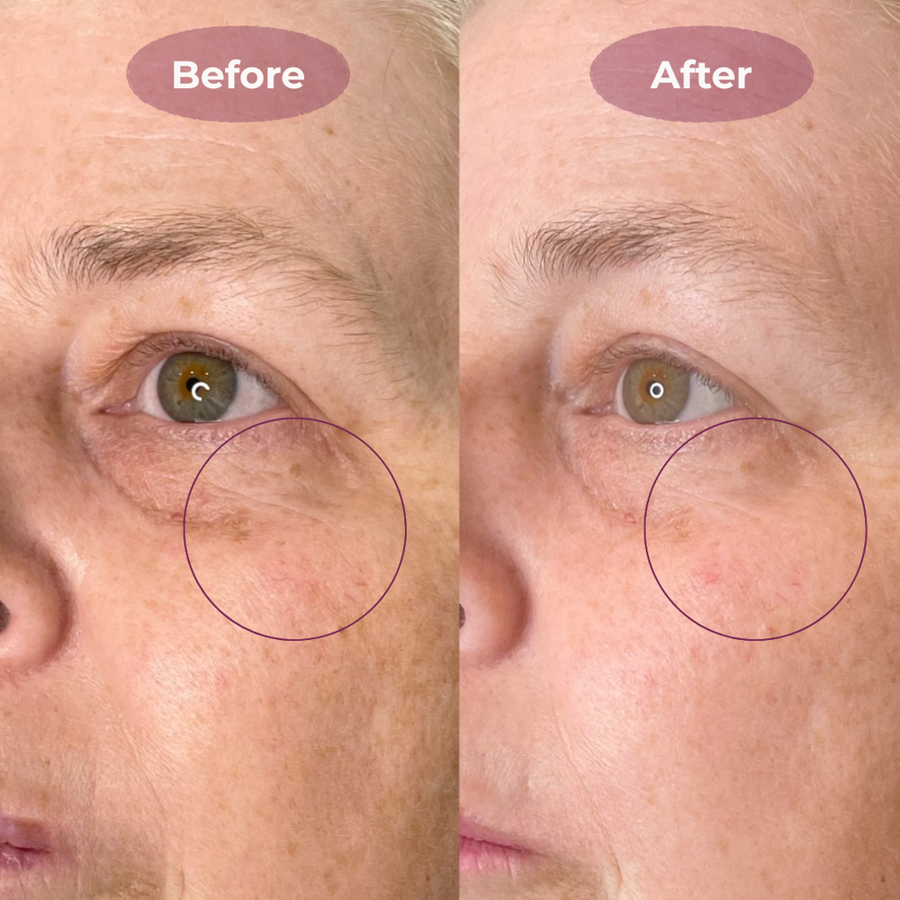 <h2>See Why Women Love Belleh</h2>