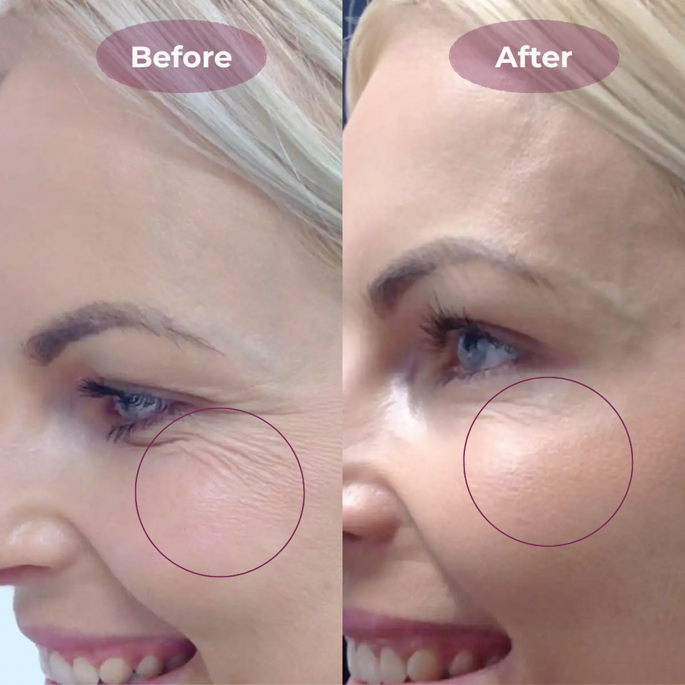 <h2>See Why Women Love Belleh</h2>