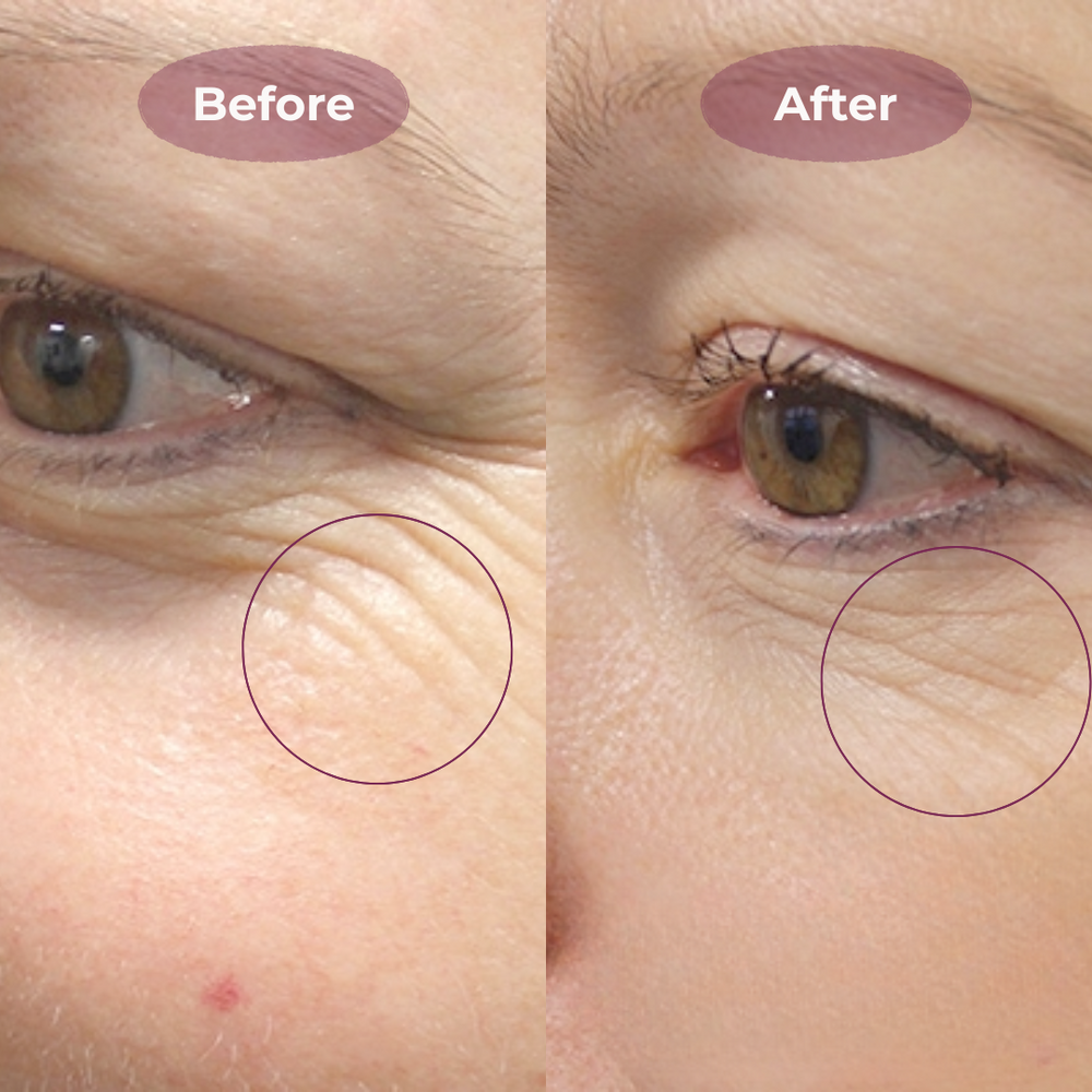 <h2>See Why Women Love Belleh</h2>