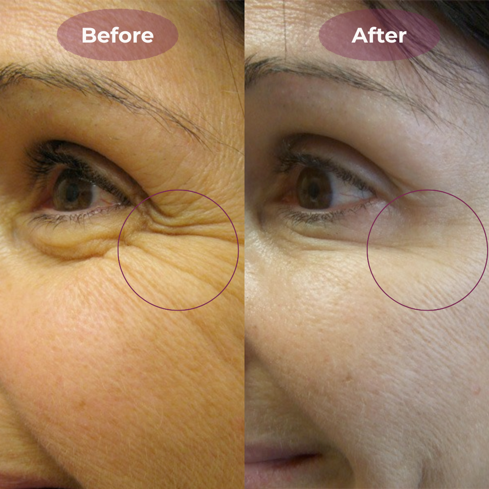 <h2>See Why Women Love Belleh</h2>